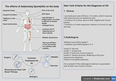 Vesicular traffic-mediated cell-to-cell signaling at the immune synapse in Ankylosing Spondylitis